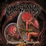 Malignancy – Intrauterine Cannibalism